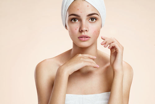 Struggle City with your Skin??