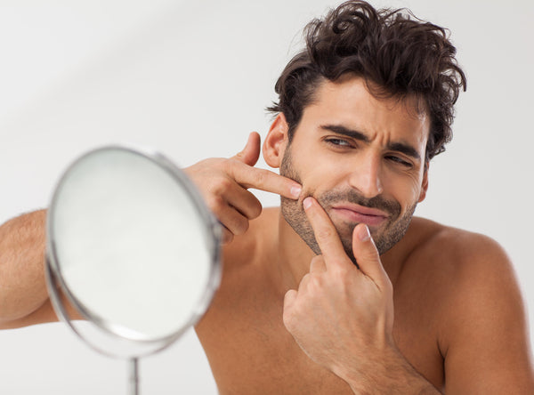 What are Facial Milia?
