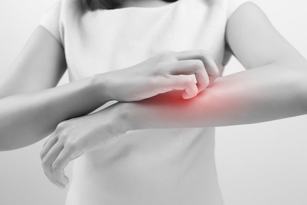 What is Eczema?
