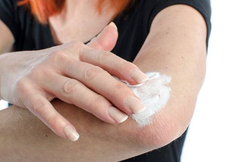 What is Eczema